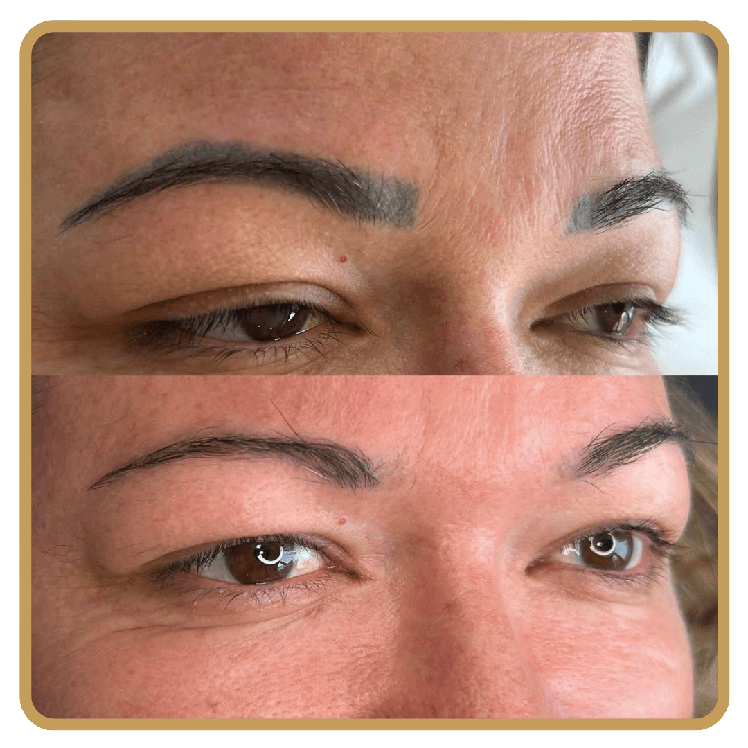 Micropigmentação de Tatuagem